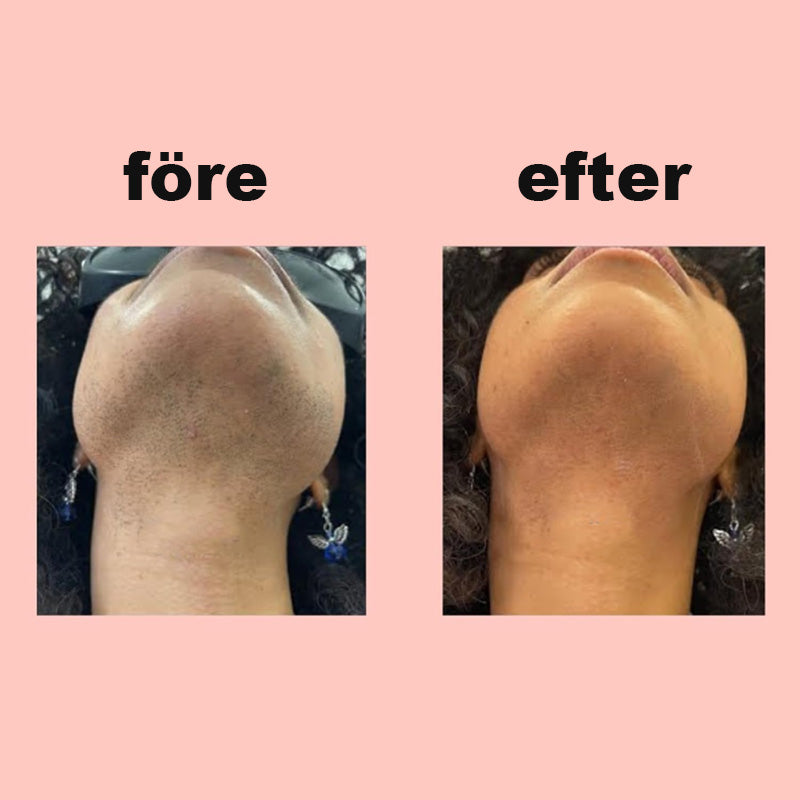Speciell Hårborttagningskräm För Hårborttagning I Ansiktet/Depilatory cream for facial hair removal