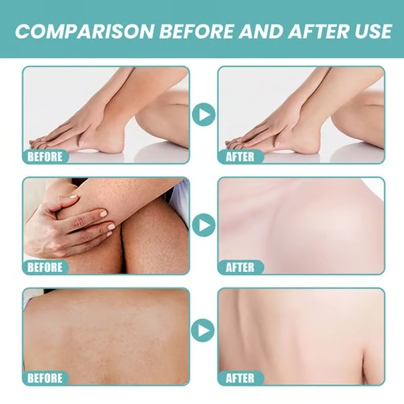 🛁 Njut av ren lyx – 49 % RABATT – ✨ Ultra-återfuktande bad- och duscholja – för silkeslen hud och naturligt myggskydd!